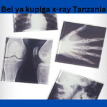 Bei ya Kupiga X-rays Tanzania