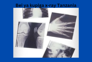 Bei ya Kupiga X-rays Tanzania