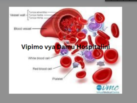 Vipimo vya Damu Hospitalini